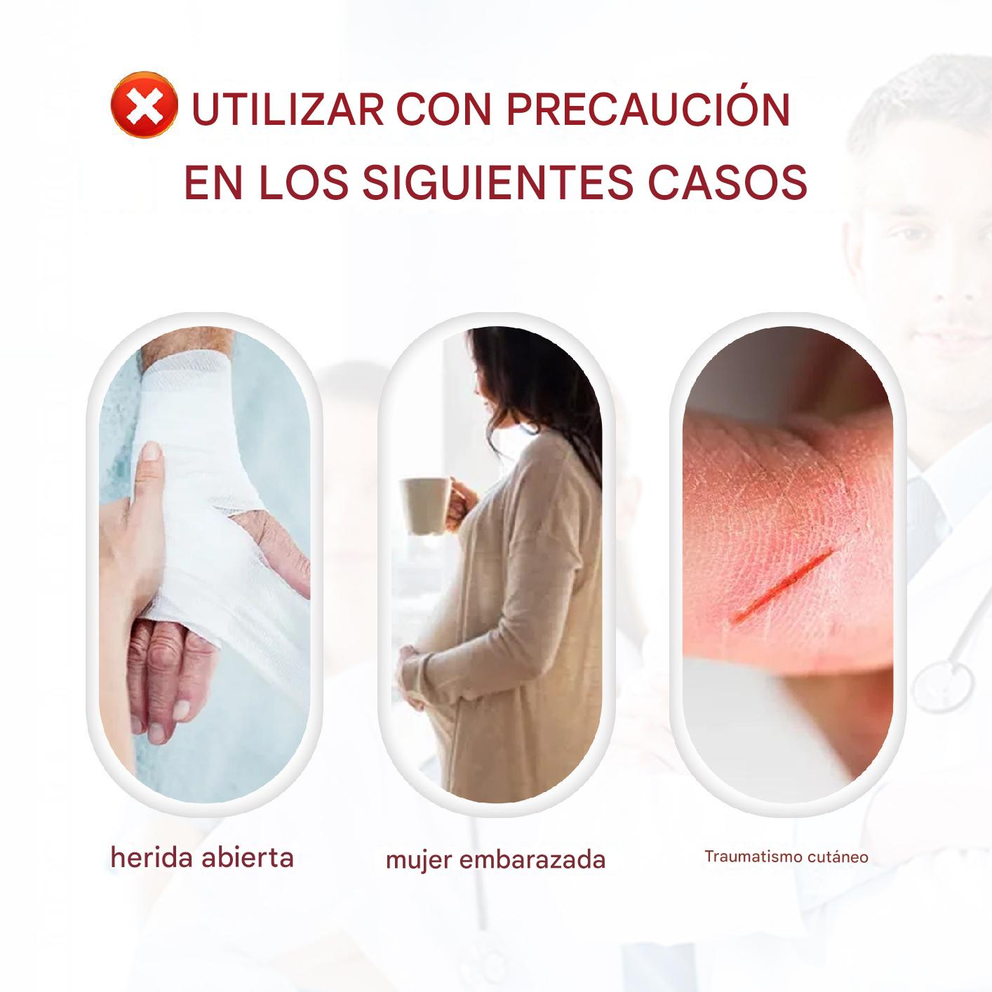 Crema para desvanecer las varices